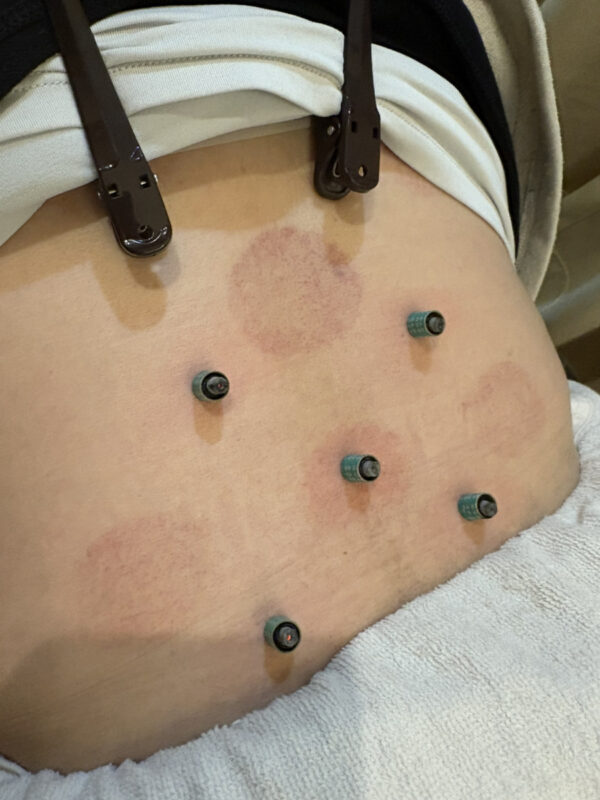 とっぷ整体整骨院|岸和田市 春木駅近く | 口コミ評価で、おすすめ人気ランキングが高い理由とは?岸和田市春木 | とっぷ整体整骨院 とっぷ整体整骨院|岸和田市 春木駅近く | 口コミ評価で、おすすめ人気ランキングが高い理由とは?岸和田市春木 | とっぷ整体整骨院